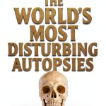 Forensic Pathology Kindle eBook by Expert Author, 71 Pages-0